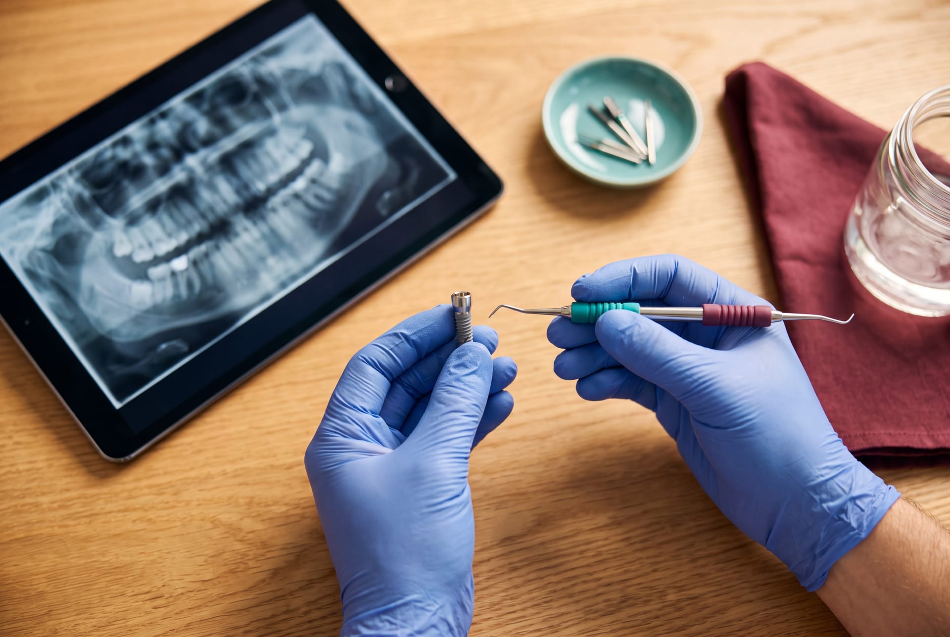 Manos de un especialista sosteniendo un modelo de implante dental sobre un escritorio